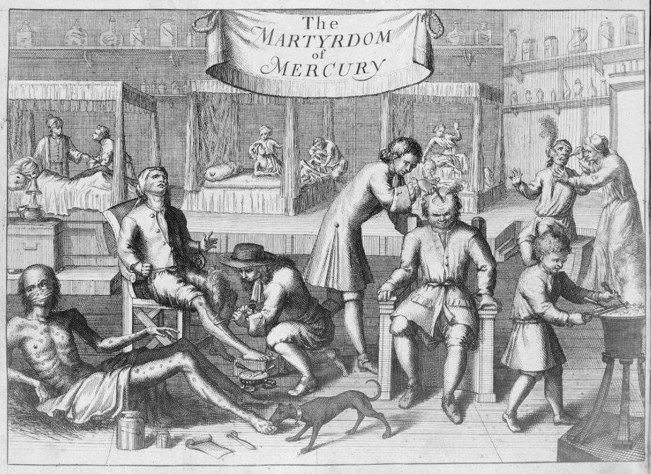 “The Martyrdom of Mercury.” “The Scourge of Venus and Mercury,” depicted in a treatise on venereal diseases by Johannes Sintelaer (1709). The image shows patients undergoing treatment for syphilis in an 18th-century hospital