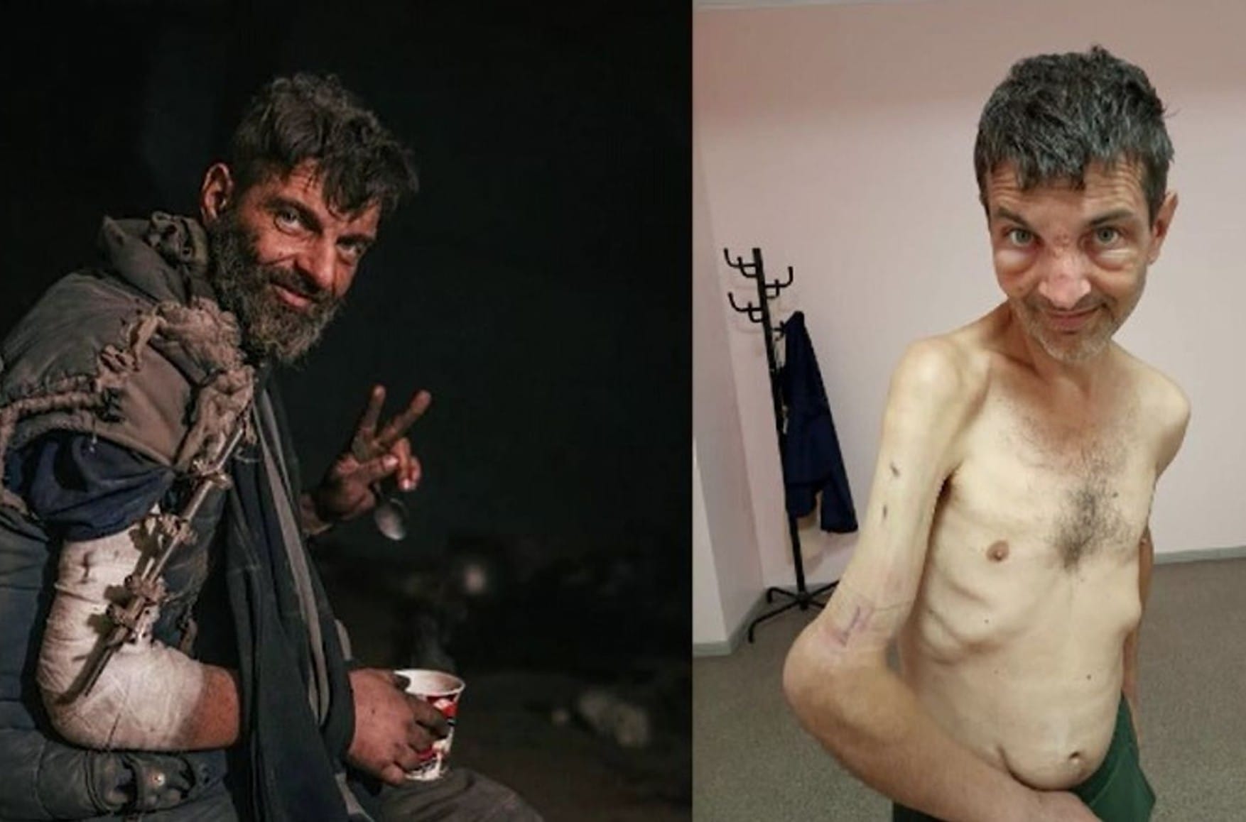 Starved, beaten, tasered: returned Azovstal defender recounts torture in Russian captivity