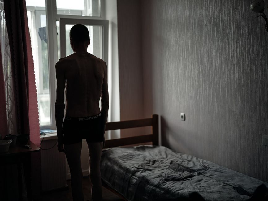 A Ukrainian soldier after Russian captivity.